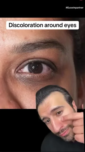 Eucerin video ad: an expert in scrubs applies an under-eye cream