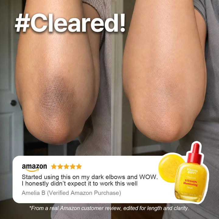 Before and after image ad from Eqqualberry